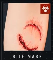 Come individuare gli infetti – Zona di quarantena: l'ultimo controllo